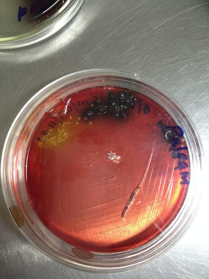 listeria listeria